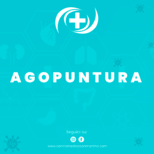 Agopuntura